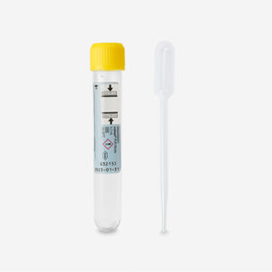 PCR Diagnostiek SOA Urine man