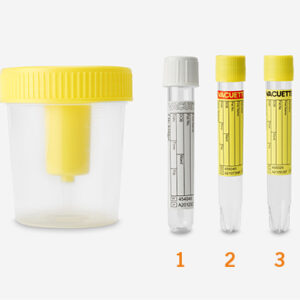 Urine onderzoek set