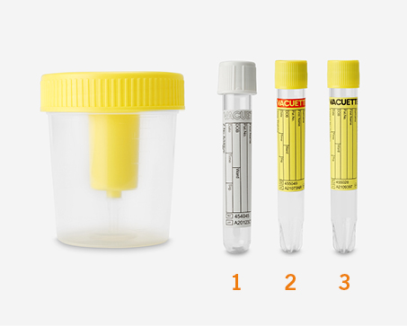 Urine onderzoek set Urine onderzoek set